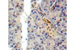 Immunohistochemistry (IHC) image for anti-Semaphorin 7A, GPI Membrane Anchor (John Milton Hagen Blood Group) (SEMA7A) (AA 318-566) antibody (ABIN1870746)