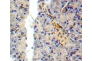 Used in DAB staining on fromalin fixed paraffin-embedded pancreas tissue (SEMA7A 抗体  (AA 318-566))