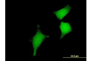 Immunofluorescence of purified MaxPab antibody to GLRX2 on HeLa cell. (Glutaredoxin 2 抗体  (AA 1-124))