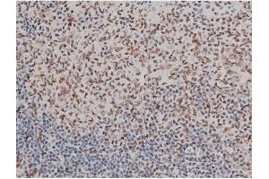 ABIN6254982 and ABIN6267395 at 1/200 staining Rat spleen tissue sections by IHC-P.