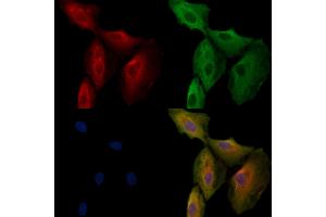 ABIN6263894 and ABIN6272730 staining  cells by IF/ICC.