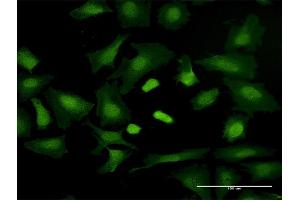 Immunofluorescence of purified MaxPab antibody to TRGV3 on HeLa cell. (TRGV3 抗体  (AA 1-200))