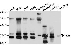 Western blot analysis of extracts of various cell lines, using GJB1 antibody (ABIN6003810) at 1/1000 dilution. (GJB1 抗体)