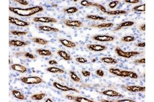 IHC testing of FFPE mouse kidney with SLC12A1 antibody. (SLC12A1 抗体)