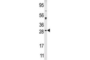 anti-KIP2 antibody