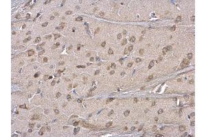 Immunohistochemistry (IHC) image for anti-Endoplasmic Reticulum Protein 29 (ERP29) antibody (ABIN2855330)