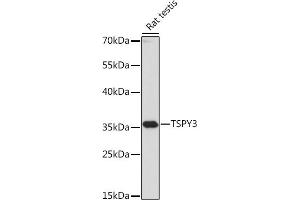 Western blot analysis of extracts of Rat testis, using TSPY3 antibody (ABIN7270776) at 1:1000 dilution. (TSPY3 抗体  (AA 1-308))