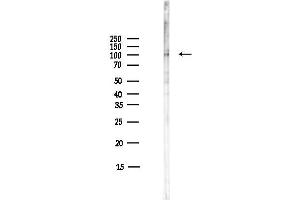 Western blot analysis of lysates from COLO205 cells(heat-shock,45 min treatment), using CDH11 Antibody at 1/1000 dilution.