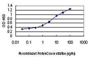 Detection limit for recombinant GST tagged DAPK1 is approximately 0. (DAP Kinase 1 抗体  (AA 1211-1310))