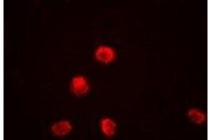 Immunofluorescent analysis of KDM1A staining in Jurkat cells. (LSD1 抗体)