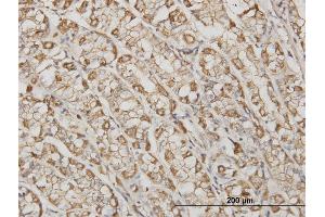 Immunoperoxidase of monoclonal antibody to ACTB on formalin-fixed paraffin-embedded human stomach. (beta Actin 抗体  (AA 1-375))
