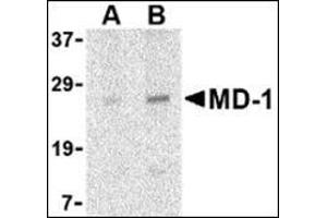 Western blot analysis of MD-1 in Daudi cell lysate with this product at (A) 1 and (B) 2 μg/ml. (LY86 抗体  (Center))