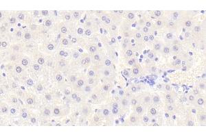 Immunohistochemistry (IHC) image for anti-Von Willebrand Factor A Domain Containing 1 (VWA1) (AA 43-285) antibody (ABIN7440287)