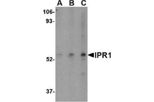 Western blot analysis of IPR1 in Hela cell lysate with IPR1 antibody at (A) 0. (SP110 抗体  (C-Term))