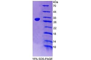 SDS-PAGE analysis of Rat NXF1 Protein. (NXF1 蛋白)