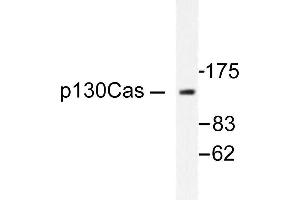 Image no. 1 for anti-Breast Cancer Anti-Estrogen Resistance 1 (BCAR1) antibody (ABIN271903) (BCAR1 抗体)