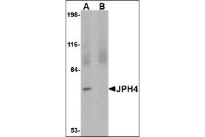 Western blot analysis of JPH4 in 293 cell lysate with this product at 1 μg/ml in (A) the absence and (B) the presence of blocking peptide. (Junctophilin 4 抗体  (C-Term))