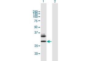 Western Blot analysis of RAET1E expression in transfected 293T cell line by RAET1E MaxPab polyclonal antibody. (Retinoic Acid Early Transcript 1E (RAET1E) (AA 1-263) 抗体)
