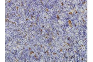 Immunoperoxidase of monoclonal antibody to ME1 on formalin-fixed paraffin-embedded human tonsil. (ME1 抗体  (AA 1-572))