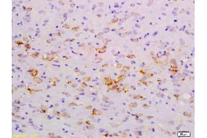 Formalin-fixed and paraffin embedded rat brain labeled with Anti-NFkB Inducing Kinase NIK Polyclonal Antibody, Unconjugated (ABIN724520) at 1:200 followed by conjugation to the secondary antibody and DAB staining (MAP3K14 抗体  (AA 901-947))