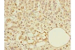 Immunohistochemistry of paraffin-embedded human adrenal gland tissue using ABIN7144926 at dilution of 1:100 (ABCF3 抗体  (AA 201-500))