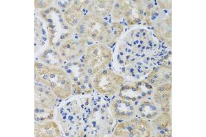 Immunohistochemistry (Paraffin-embedded Sections) (IHC (p)) image for anti-Tubulin, beta 8 (TUBB8) antibody (ABIN6149690)