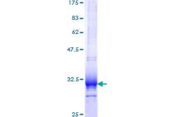 UCP1 Protein (AA 232-267) (GST tag)