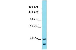 Western Blotting (WB) image for anti-MYCBP Associated Protein (MYCBPAP) (N-Term) antibody (ABIN2774232) (MYCBPAP 抗体  (N-Term))