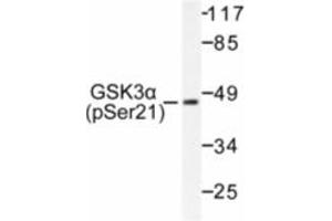 Image no. 1 for anti-Glycogen Synthase Kinase 3 alpha (GSK3a) (pSer21) antibody (ABIN318029) (GSK3 alpha 抗体  (pSer21))
