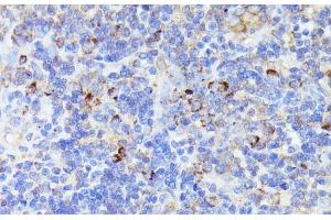 Immunohistochemistry of paraffin-embedded Rat lymph node using CCDC6 Polyclonal Antibody at dilution of 1:100 (40x lens). (CCDC6 抗体)