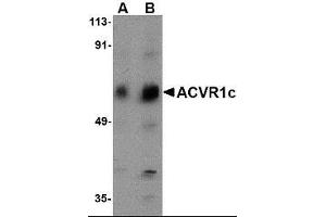 Western blot analysis of ACVR1C in human placenta tissue lysate with ACVR1C antibody at (A) 1 and (B) 2 ug/ml. (ACVR1 抗体  (N-Term))