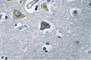 Image no. 2 for anti-Carbonic Anhydrase VB, Mitochondrial (CA5B) antibody (ABIN317824) (CA5B 抗体)