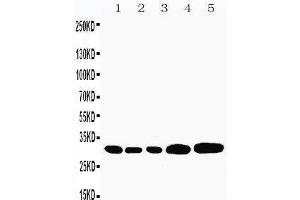 Anti-Caspase-3(P10) antibody,  Western blotting Lane 1: Rat Liver Tissue Lysate Lane 2: Rat Thymus Tissue Lysate Lane 3: Rat Spleen Tissue Lysate Lane 4: HEPA Cell Lysate Lane 5: NEURO Cell Lysate (Caspase 3 抗体  (C-Term))
