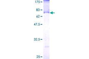 LGALS8 Protein (AA 1-358) (GST tag)