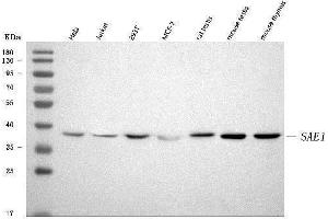 Western blot analysis of SAE1 using anti-SAE1 antibody (ABIN7601346).