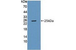 Detection of Recombinant LAMa4, Mouse using Polyclonal Antibody to Laminin Alpha 4 (LAMa4) (LAMa4 抗体  (AA 745-940))
