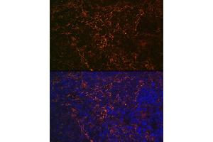 Immunofluorescence (IF) image for anti-Fc Fragment of IgE, Low Affinity II, Receptor For (CD23) (FCER2) antibody (ABIN7267160)