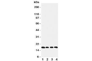 Western blot testing of Cyclophilin B antibody and Lane 1:  rat ovary (PPIB 抗体  (C-Term))