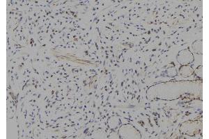 ABIN6277776 at 1/100 staining Human gastric tissue by IHC-P. (HES1 抗体  (Internal Region))