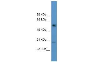 WB Suggested Anti-Ppp2r2c Antibody Titration: 0. (PPP2R2C 抗体  (N-Term))