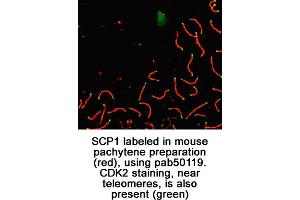 Image no. 1 for anti-Synaptonemal Complex Protein 1 (SYCP1) (C-Term) antibody (ABIN363428) (SYCP1 抗体  (C-Term))