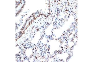 Immunohistochemistry of paraffin-embedded rat lung using Histone H2A Rabbit mAb (ABIN7267703) at dilution of 1:100 (40x lens). (HIST1H2AE 抗体)