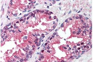 Human Prostate (formalin-fixed, paraffin-embedded) stained with VCP antibody ABIN239859 at 5 ug/ml followed by biotinylated anti-mouse IgG secondary antibody ABIN481714, alkaline phosphatase-streptavidin and chromogen. (VCP 抗体)