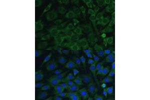 Immunofluorescence analysis of C6 cells using Oncostatin M antibody (ABIN6128404, ABIN6145072, ABIN6145073 and ABIN6221768) at dilution of 1:100. (Oncostatin M 抗体  (AA 26-252))