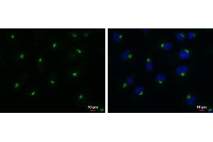 ICC/IF Image RAB6A antibody detects RAB6A protein at Golgi apparatus by immunofluorescent analysis. (RAB6A 抗体)