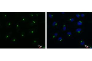 ICC/IF Image RAB6A antibody detects RAB6A protein at Golgi apparatus by immunofluorescent analysis. (RAB6A 抗体)