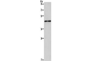 Western Blotting (WB) image for anti-Interleukin 5 Receptor, alpha (IL5RA) antibody (ABIN5546745) (IL5RA 抗体)