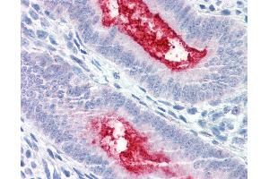 Anti-ENPP3 antibody IHC of human uterus. (ENPP3 抗体  (Internal Region))