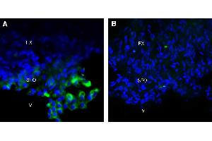 Expression of  in rat brain subfornical organ (SFO).