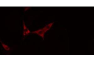 Immunofluorescence (fixed cells) (IF/ICC) image for anti-Neurotrophic Tyrosine Kinase, Receptor, Type 2 (NTRK2) (C-Term) antibody (ABIN6265746)
